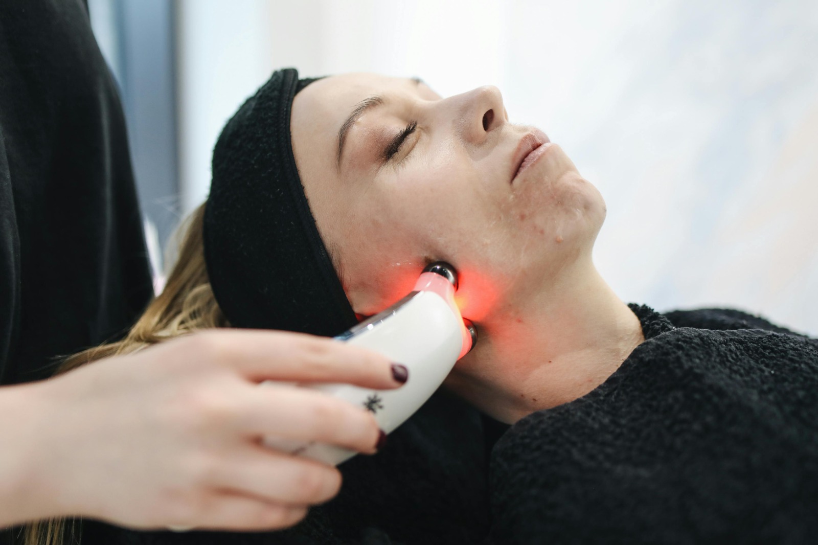 4 Innovative Face Treatments for Lasting Skin Confidence